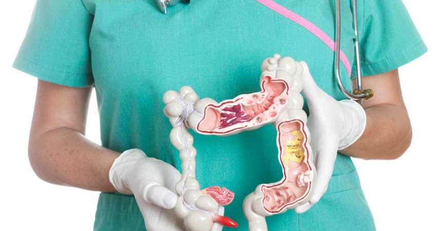 Ärztin hält Anatomisches Modell vom Darm in den Händen
