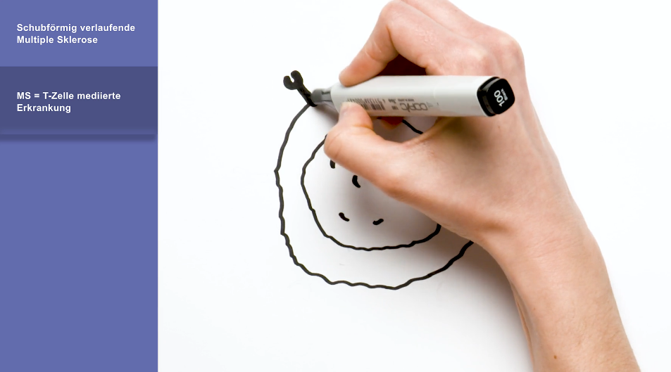 VideoProduktfortbildung OCREVUS® (Ocrelizumab)