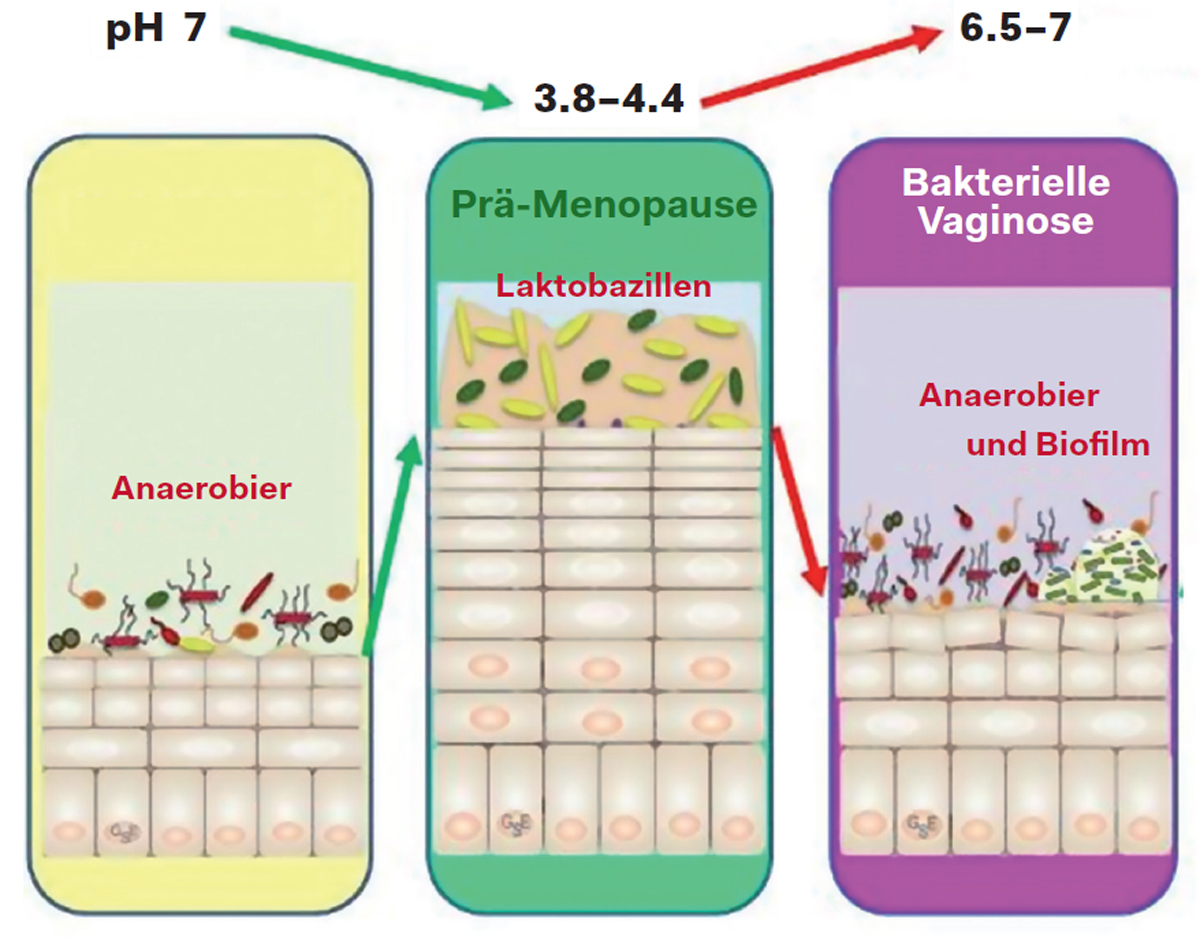 Veränderungen des Mikrobioms der Vagina