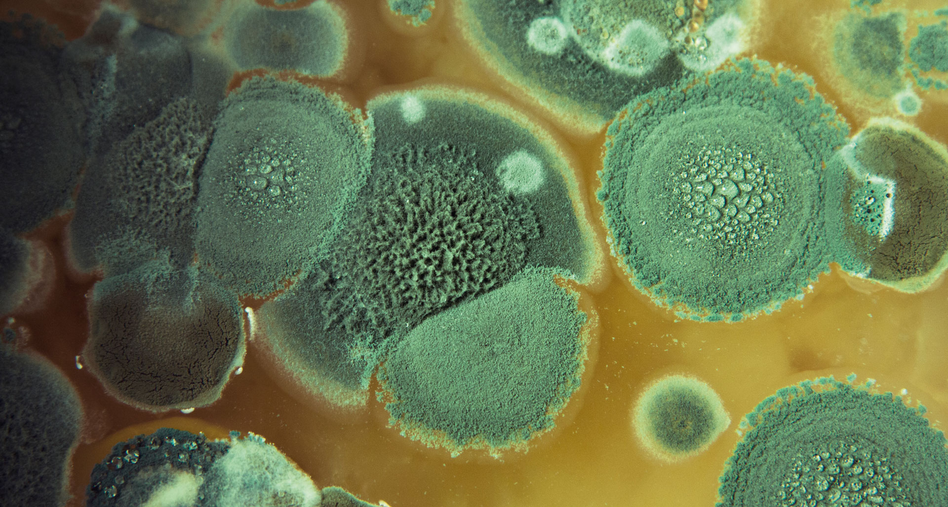 Патогенные грибы споры. Aspergillus Niger под микроскопом. Aspergillus fumigatus споры. Aspergillus fumigatus колонии. Плесень Aspergillus fumigatus.