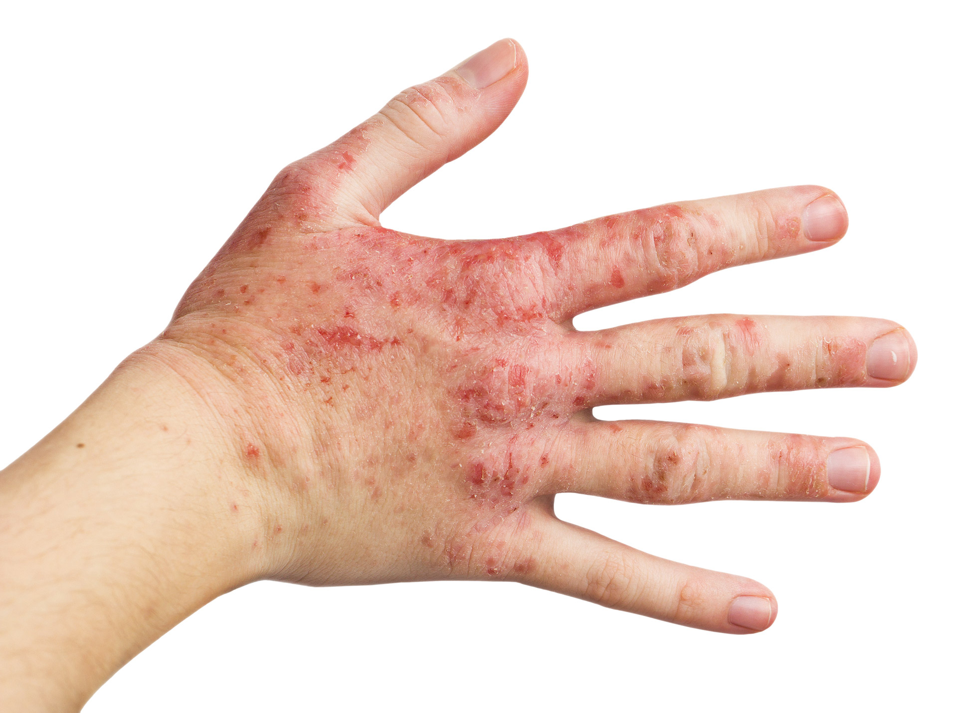 DFP Literaturstudium Berufsdermatologie