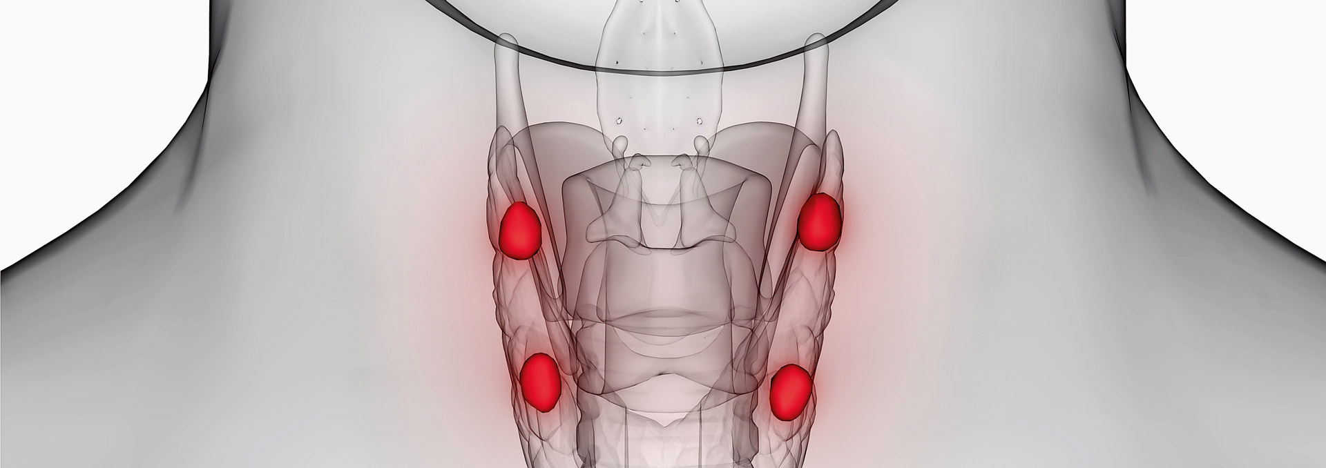 Hypoparathyreoidismus Ein Hormon steht parat, jedoch nicht als FirstLine