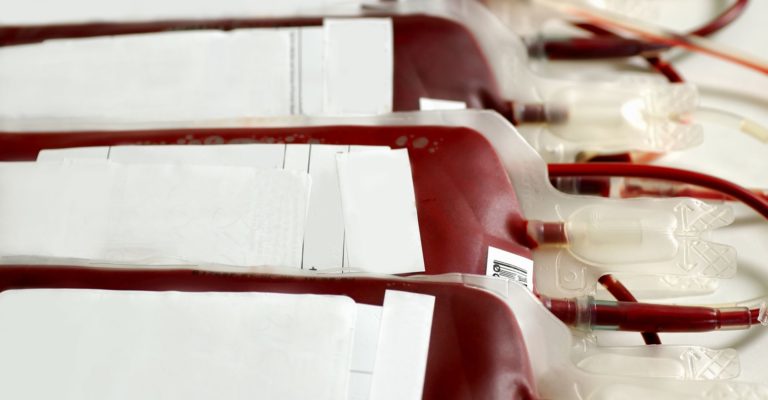 Trend der Zeit die haploidente Stammzelltransplantation