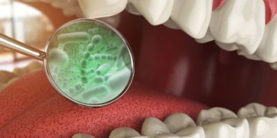 Bakterien und Viren um den Zahn. Medizinisches Konzept der Zahnhygiene. 3D-Illustration