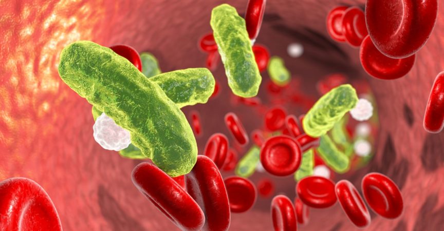 Sepsis, Bakterien im Blut. 3D-Darstellung zeigt stäbchenförmige Bakterien im Blut mit roten Blutkörperchen und Leukozyten