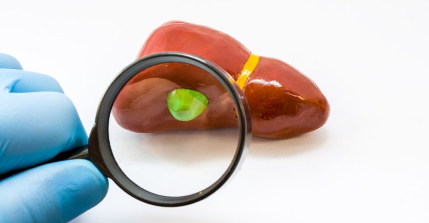 Diagnose der Gallenblase bei Vorliegen einer Krankheit. Doktor Hand in Hand mit Lupengallenblase auf anatomischem Lebermodell auf weißem Hintergrund untersuchen. Konzept für Chirurgie und Gastroenterologie