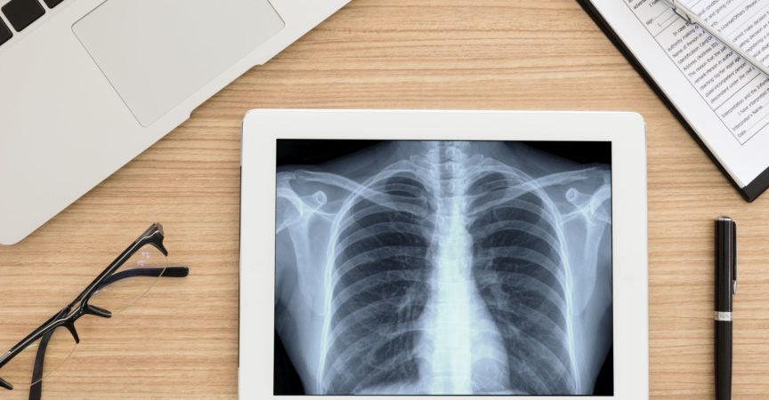 Gesundheitswesen und medizinisches Konzept. Lungenröntgenbild des Scan-Brustpatienten auf digitalem Tablettbildschirm. Draufsicht.