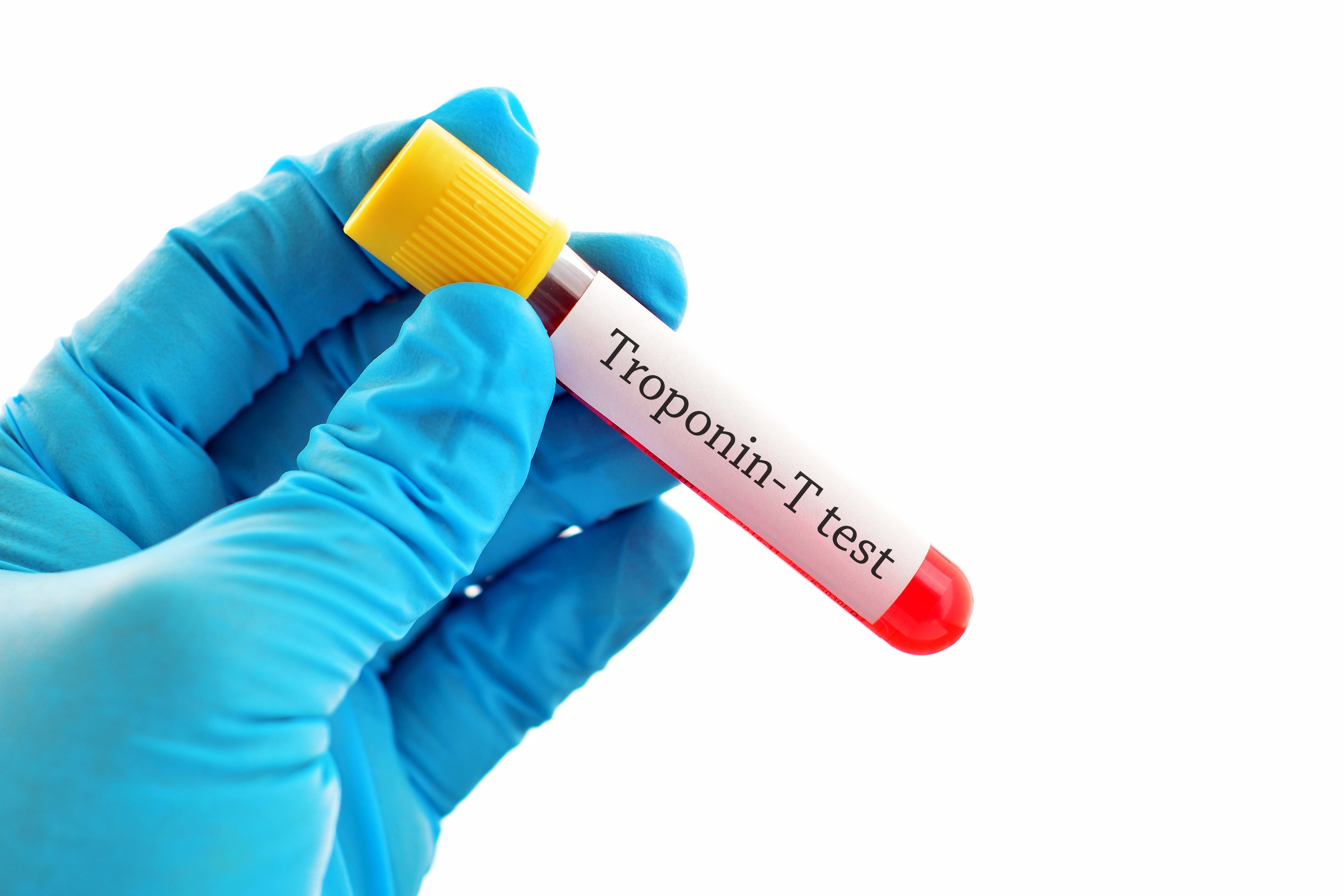 neurogenes-troponin-medonline