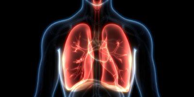 Dicker Lymphknoten Wie Viel Diagnostik Medical Tribune Schweiz