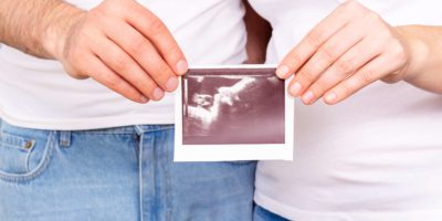 Eltern, die Ultraschallfoto-Baby in Händen halten.