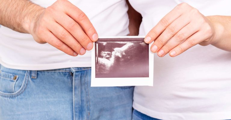 Eltern, die Ultraschallfoto-Baby in Händen halten.