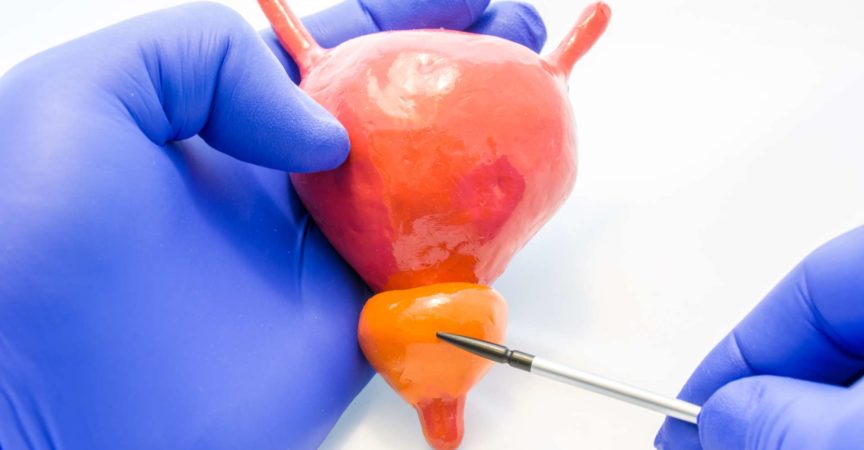 Arzt, Wissenschaftler, Lehrer oder Experte für Anatomie zeigt Zeiger auf Prostata nach Modell der Organe der Harnwege - Blase und Prostata. Ort des Auftretens von Anomalien wie Prostatitis