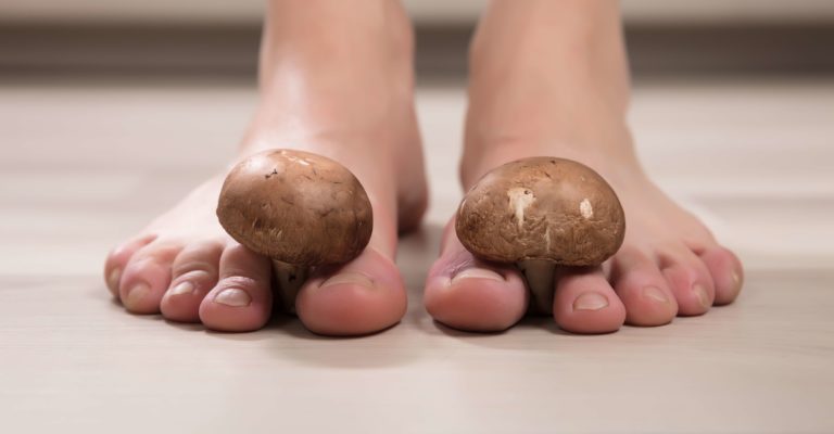 Nahaufnahme der Füße einer Frau mit essbaren Pilzen zwischen den Zehen