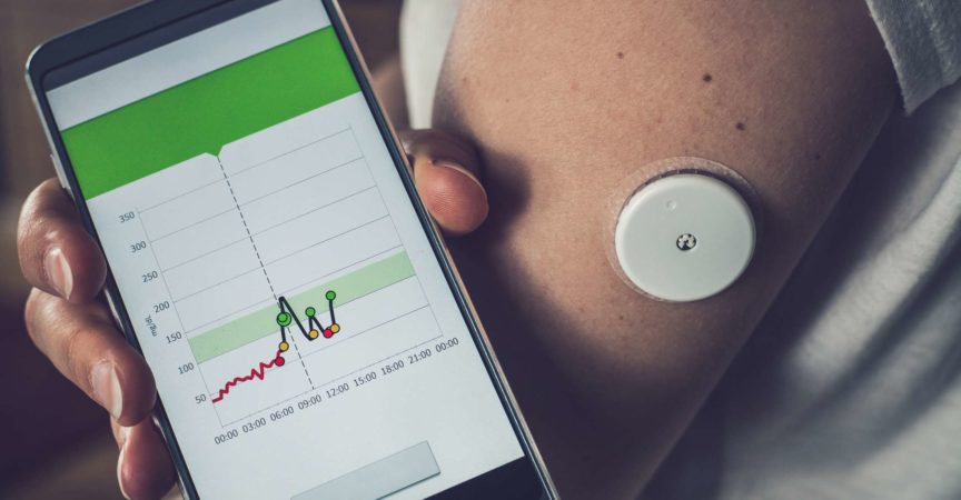 Frau, die Glukosespiegel mit einem entfernten Sensor und Mobiltelefon prüft, Sensor, der Glukosespiegel ohne Blut überprüft. Diabetes-Behandlung.
