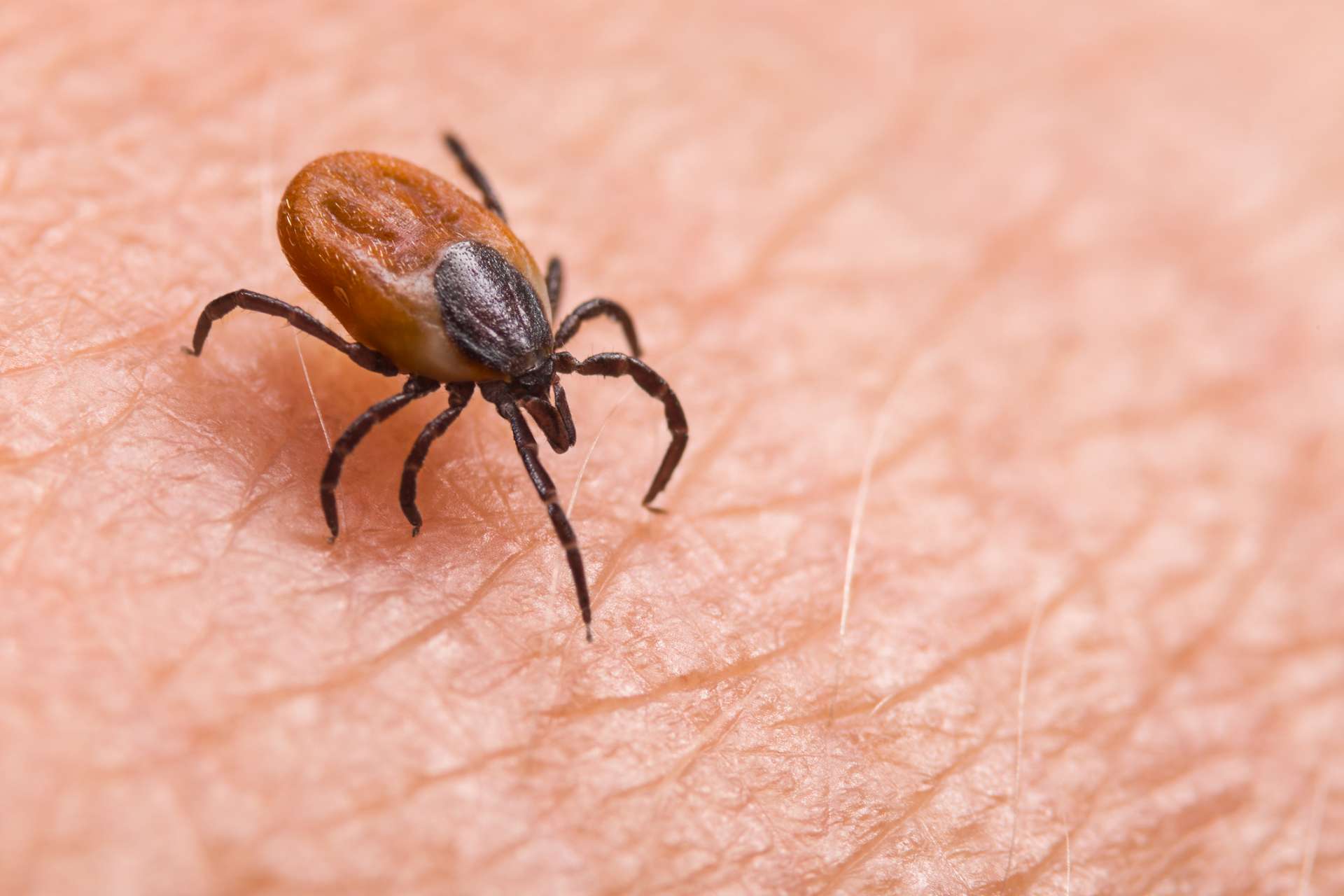 Lyme-Borreliose: Ein Buntes Klinisches Bild - Medical Tribune Schweiz