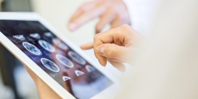 Medizinisches Team analysiert MRT-Scans auf einem digitalen Tablet