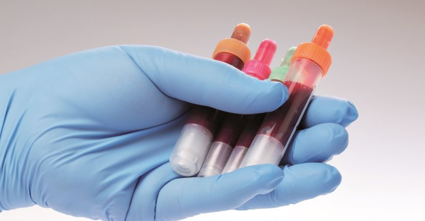 Blutproben befinden sich auf einem Laborformular zur Ermittlung der Blutwerte