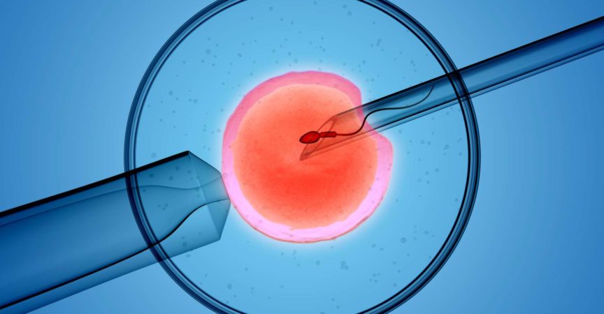 3D-Rendering des icsi-Prozesses (intrazytoplasmatische Spermieninjektion), bei dem ein einzelnes Sperma direkt in eine Eizelle injiziert wird