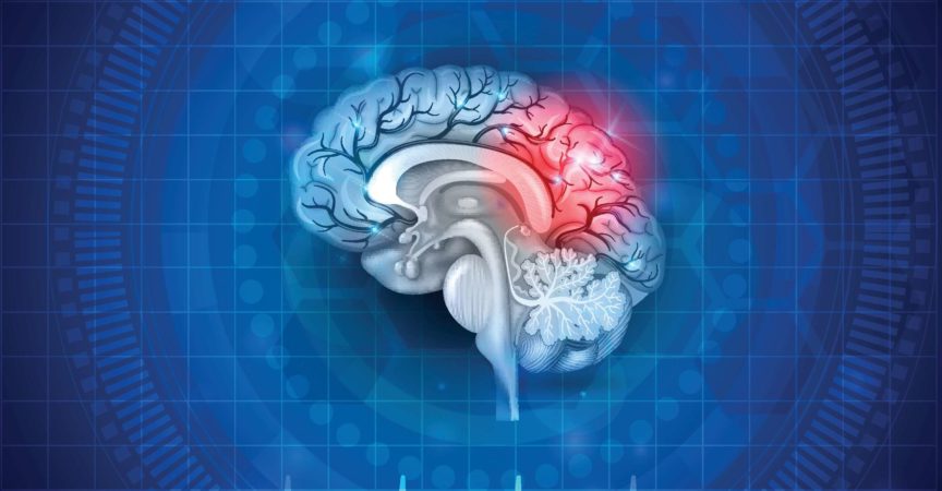 Human brain damage and treatment concept. Abstract blue background with cardiogram.