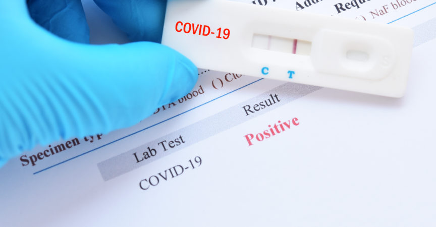 Positives Testergebnis unter Verwendung eines Schnelltestgeräts für COVID-19, neuartiges Coronavirus 2019, gefunden in Wuhan, China