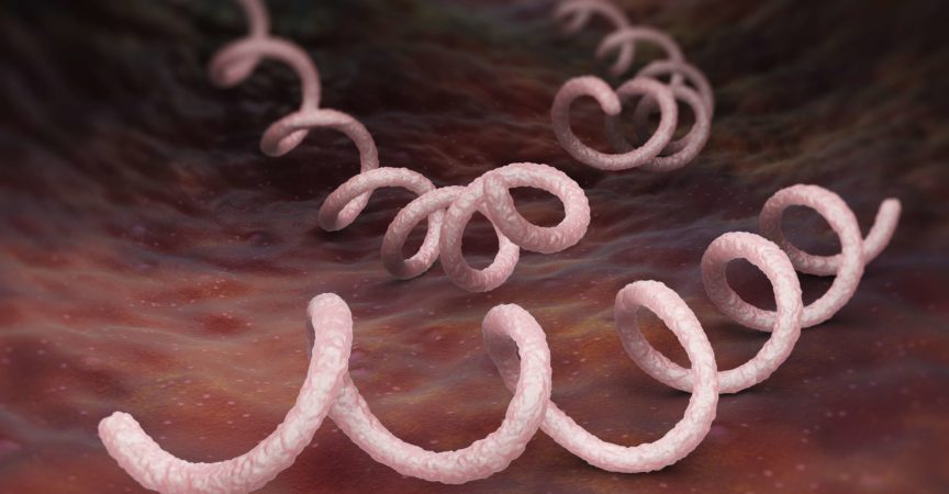 Syphilis ist eine sexuell übertragbare Infektion, die durch das Spirochätenbakterium verursacht wird