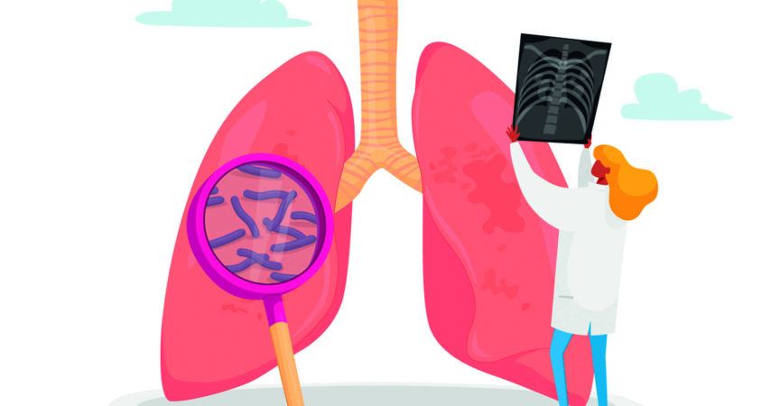 Lungenspezialist, professioneller Arzt Charakter mit Röntgenbild der Lunge Lernende Patientenfluorographie mit Tuberkulose oder Lungenentzündung, Arbeit des medizinischen Personals. Karikatur-Vektor-Illustration