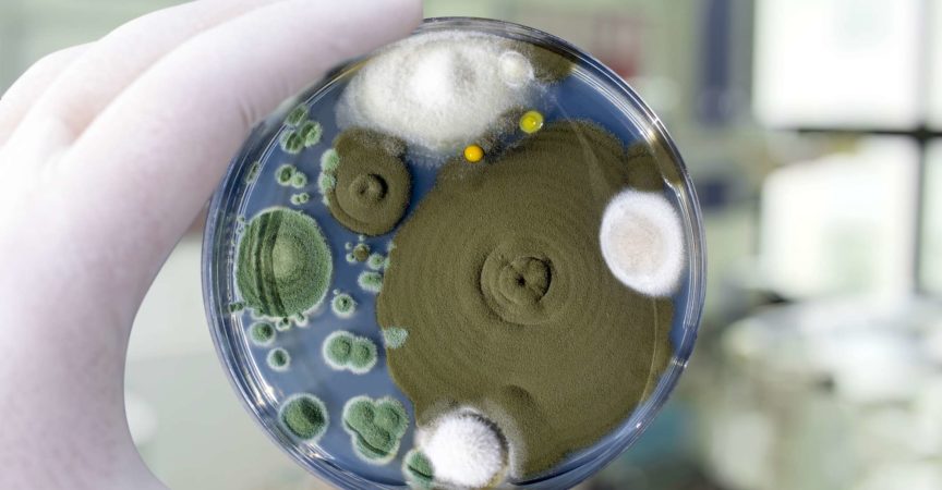 Kolonien verschiedener Schimmelpilze aus der Raumluft auf Petrischale mit Sabourad-Dextrose-Agar, Nahaufnahme. Hand in weißem Handschuh hält Platte mit Mikroben im Forschungslabor