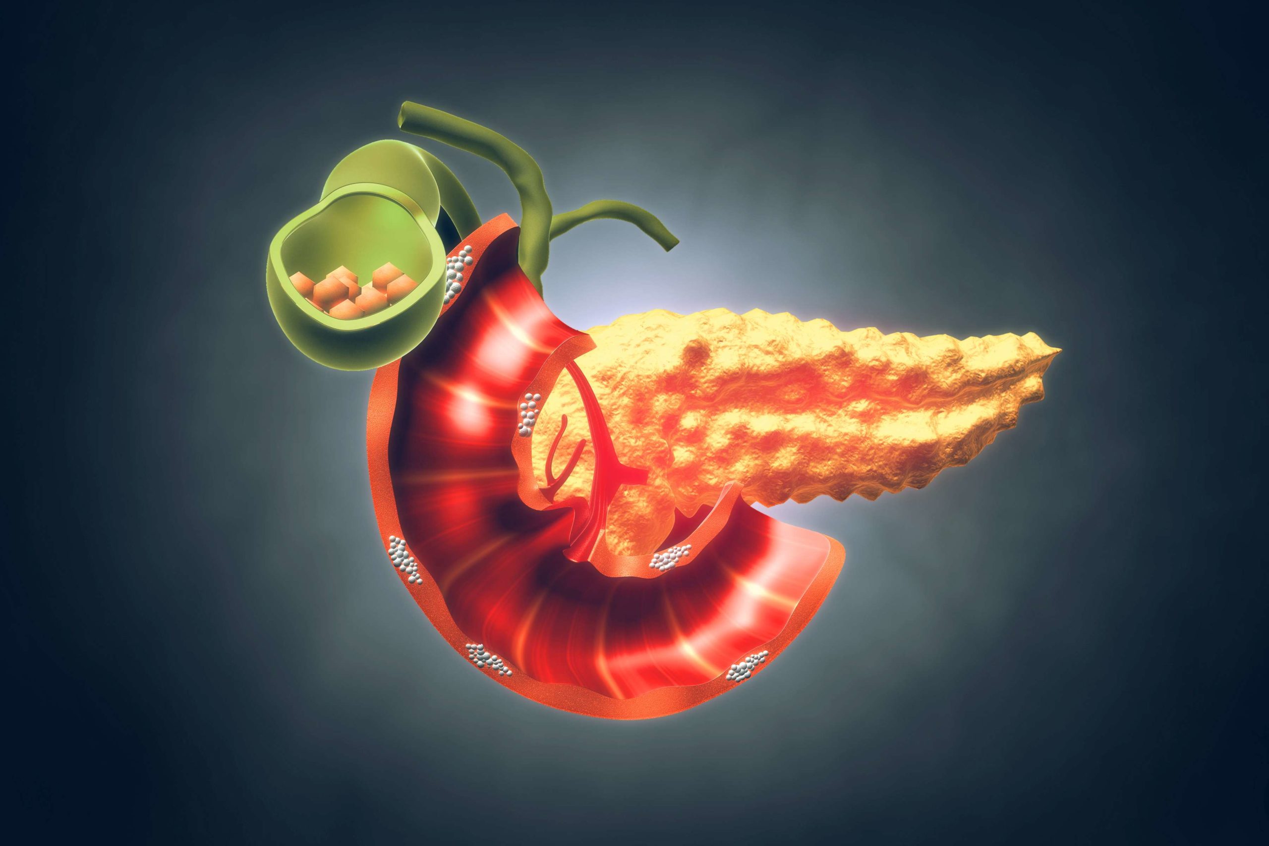 Was tun bei akuter Pankreatitis durch Hypertriglyzeridämie?