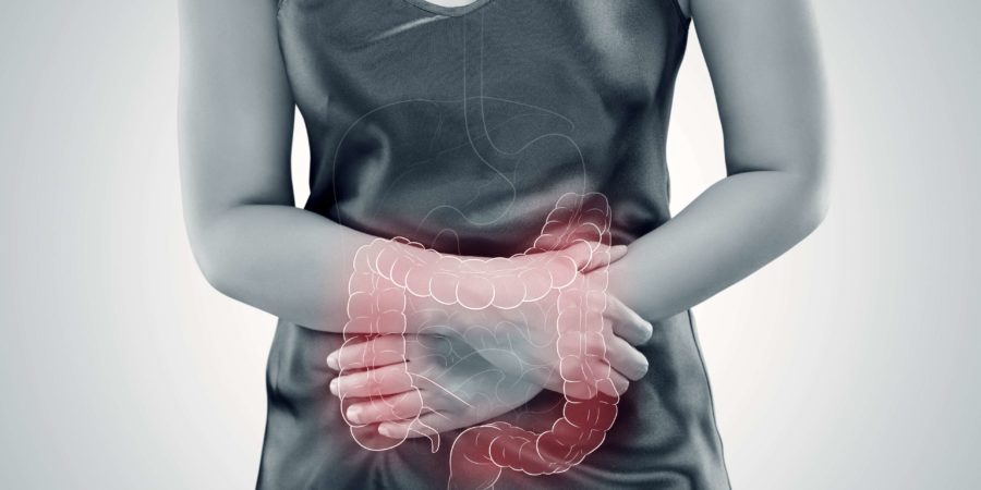 Colitis ulcerosa (UC). Darm