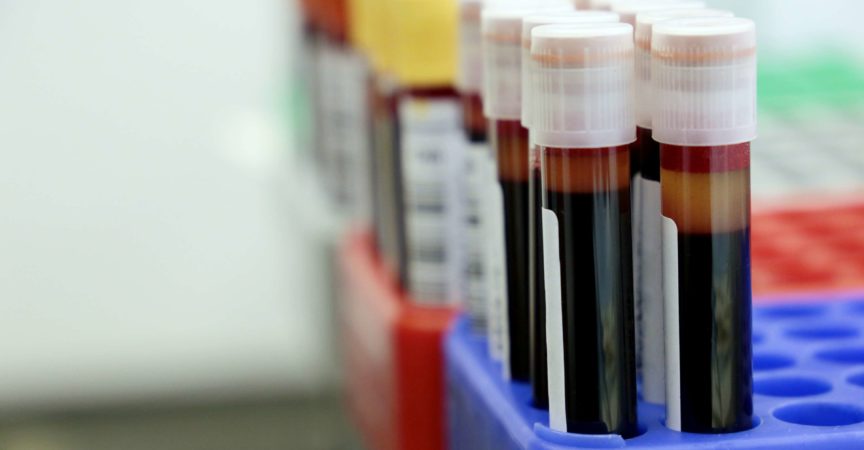 Konzept von Bluttest, Spende, Impfung, Coronavirus, Gesundheitswesen