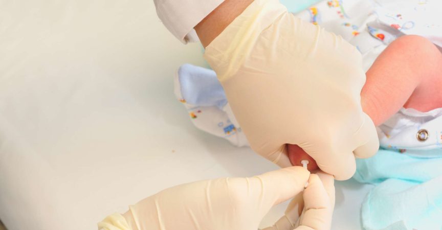 medizinische Person, die neugeborene Babyferse für Blutprobenprüfung sticht.