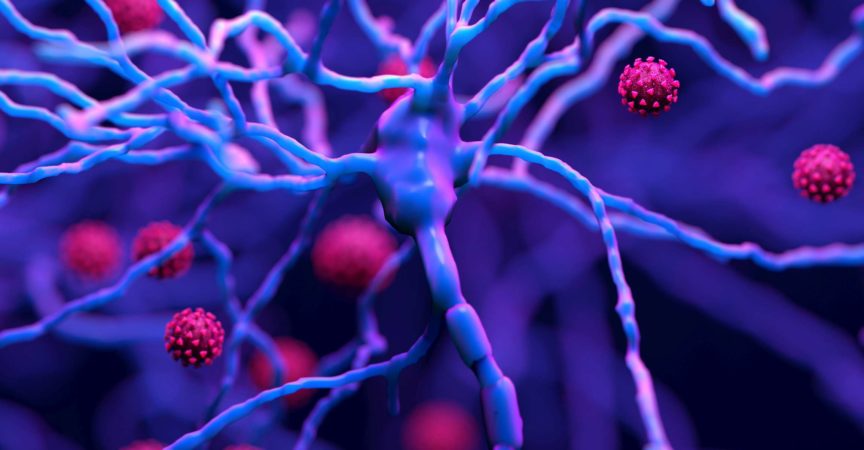 Wie COVID-19 das Gehirn schädigen kann, ist der Abbau von Myelin eine fettige Beschichtung, die Neuronen schützt.