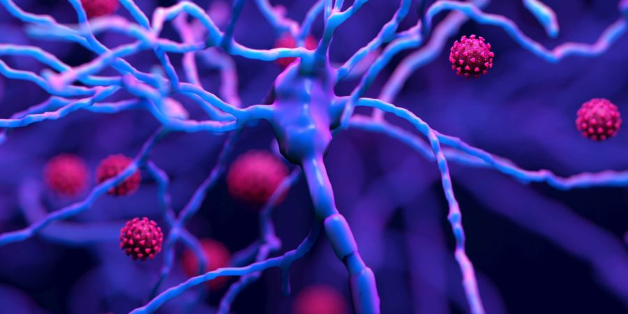 Wie COVID-19 das Gehirn schädigen kann, ist der Abbau von Myelin eine fettige Beschichtung, die Neuronen schützt.