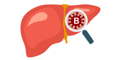 Hepatitis-B-Krankheit Konzept Vektor-Illustration