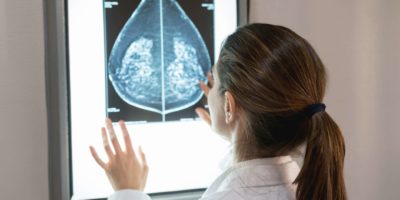 Nicht erkennbare Gynäkologin, die im Krankenhaus eine Mammographie eines Patienten betrachtet
