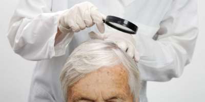Arzt untersucht die Kopfhaut einer älteren Frau, Kopfhautekzem, Dermatitis, Psoriasis, Haarausfall, Schuppen oder trockene Kopfhaut