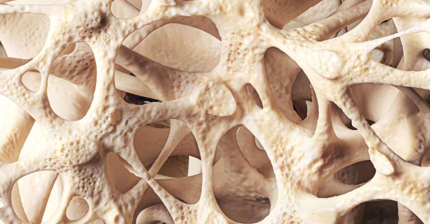 Realistische Knochenschwammstruktur Nahaufnahme, Knochenstruktur von Osteoporose betroffen, 3D-Darstellung