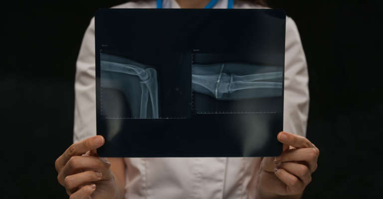 Eine Ärztin zeigt ein Röntgenbild von einem Arm