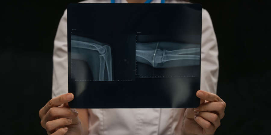 Eine Ärztin zeigt ein Röntgenbild von einem Arm