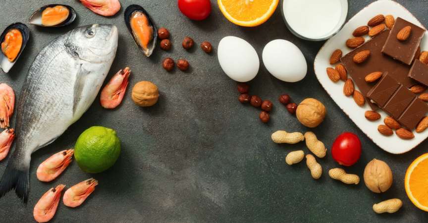 Lebensmittelallergene, Banner. Meeresfrüchte, Milch, Schokolade, Nüsse, Zitrusfrüchte, Eier. Allergisches Lebensmittelkonzept. Ansicht von oben, flach, Kopienraum.