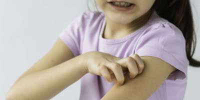 Mittelteil eines unerkennbaren kleinen Mädchens kratzt sich am Arm.