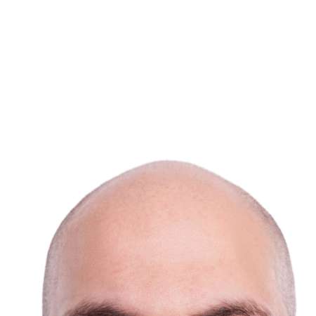 Ein Mann mit Glatze