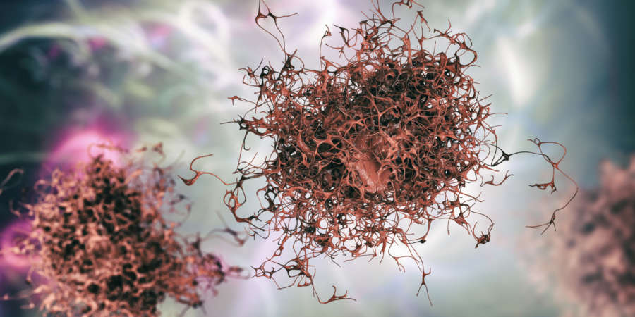 Krebszelle, bösartige Tumorzelle, 3D-Darstellung