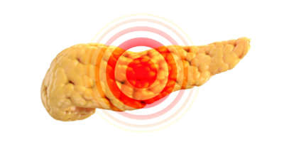 Krankheits- oder Schmerzkonzept der menschlichen Bauchspeicheldrüse isoliert auf weiß mit rotem Schmerzzeichen darauf. 3D-Darstellung