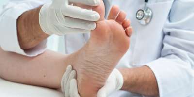 Arzt Dermatologe untersucht den Fuß auf das Vorhandensein von Fußpilz