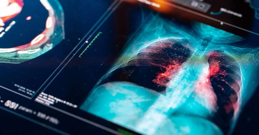 Medizinischer MRT-Scan auf digitalem Bildschirm
