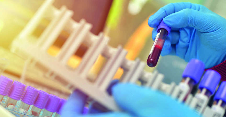 Röhrchen mit Blutproben zum Testen. Medizinische Ausrüstung