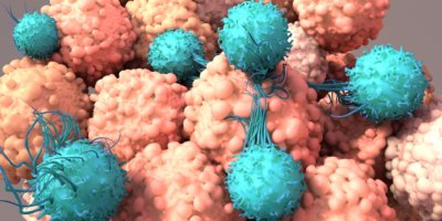 Eine kleine Untergruppe an Patienten ist für eine Immuntherapie geeignet