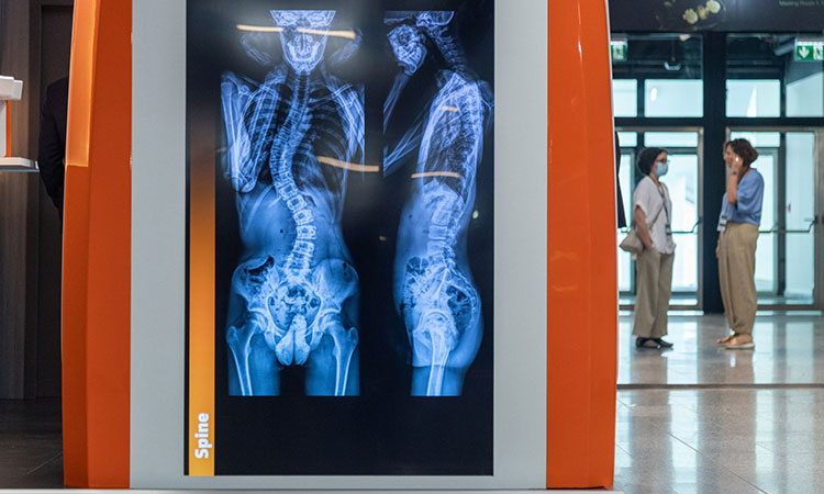 Ganzkörper-Röntgenbild auf einem LED-Plakate, drinnen - Menschen im Hintergrund