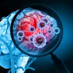 Virusinfektion des Gehirns auf wissenschaftlichem Hintergrund